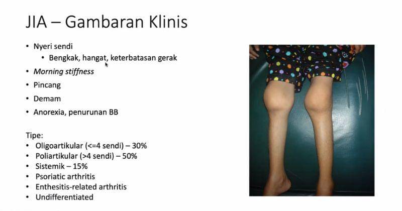 Popmama.com/Anggia Ramadhani Fitri